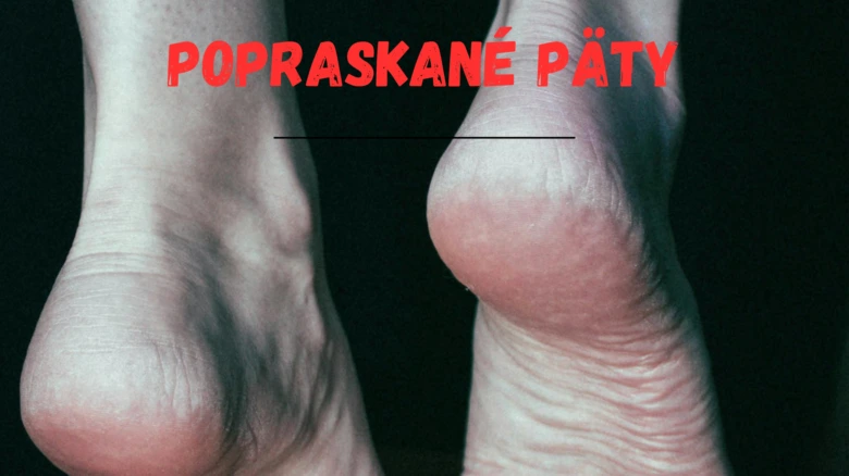 Popraskané paty - suchá kůže na podpatcích