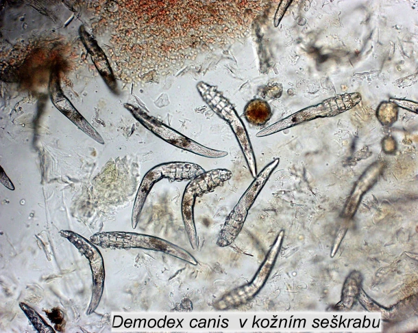 Mikroskopický pohled na klíšťata Demodex v kožním škrabu